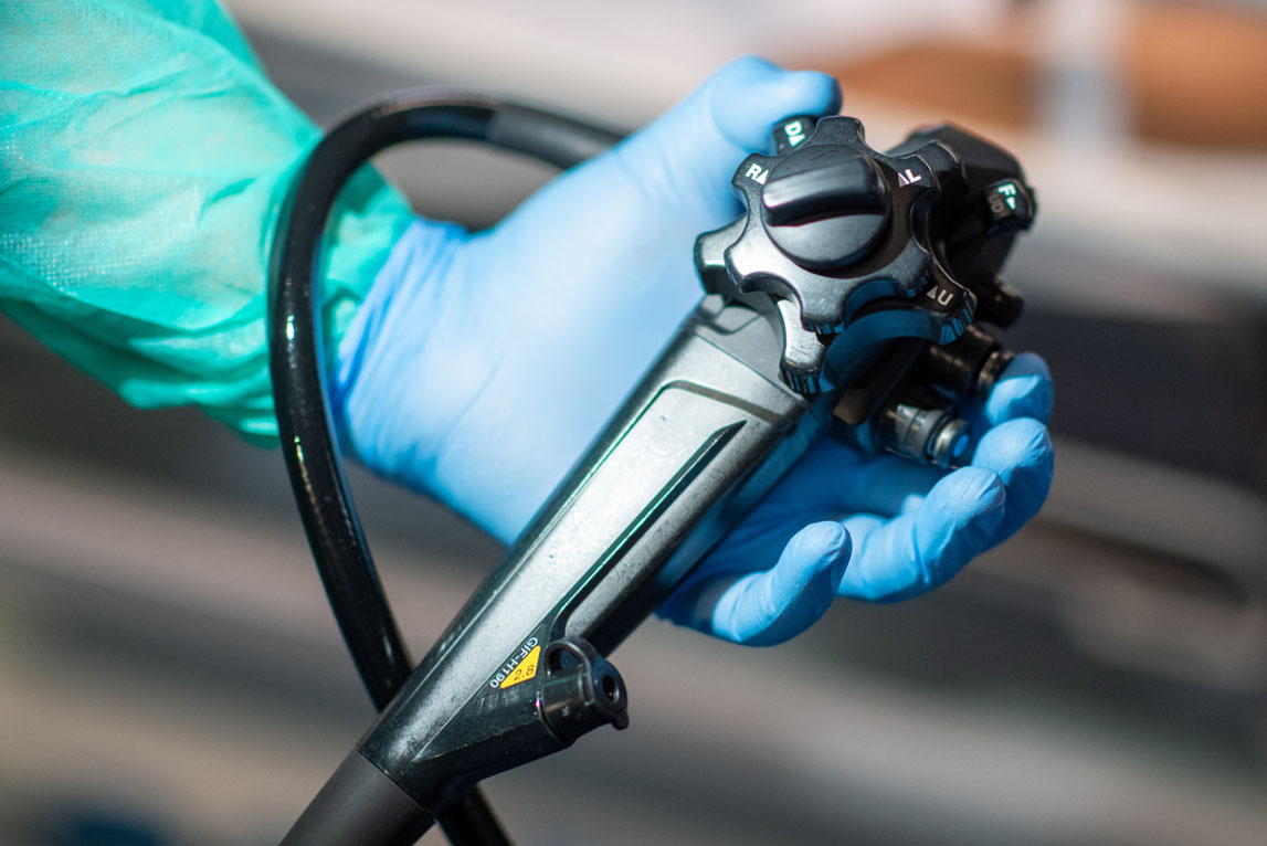 endoscope